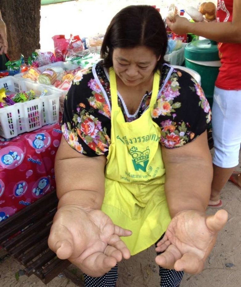 Шок! У этой женщины самые большие руки в мире
