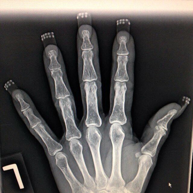 Эти рентгеновские снимки врачи точно запомнят надолго
