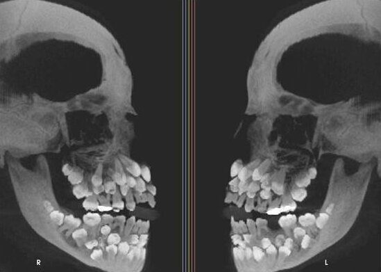 Эти рентгеновские снимки врачи точно запомнят надолго