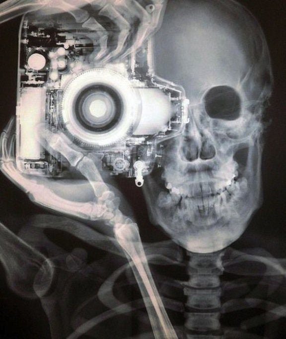 Крайне необычные рентгеновские снимки