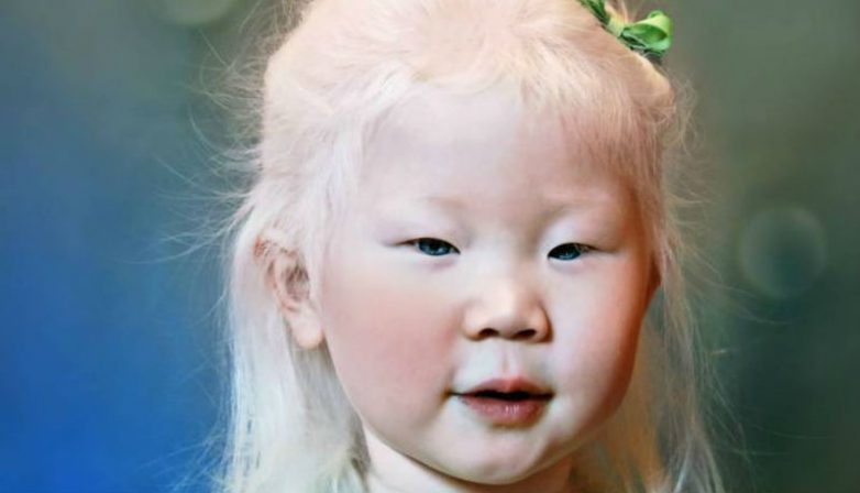 Снежная красота: удивительные альбиносы из разных стран мира