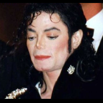 »На его голове не было…»: раскрыта сенсационная тайна Майкла Джексона. Politeka
